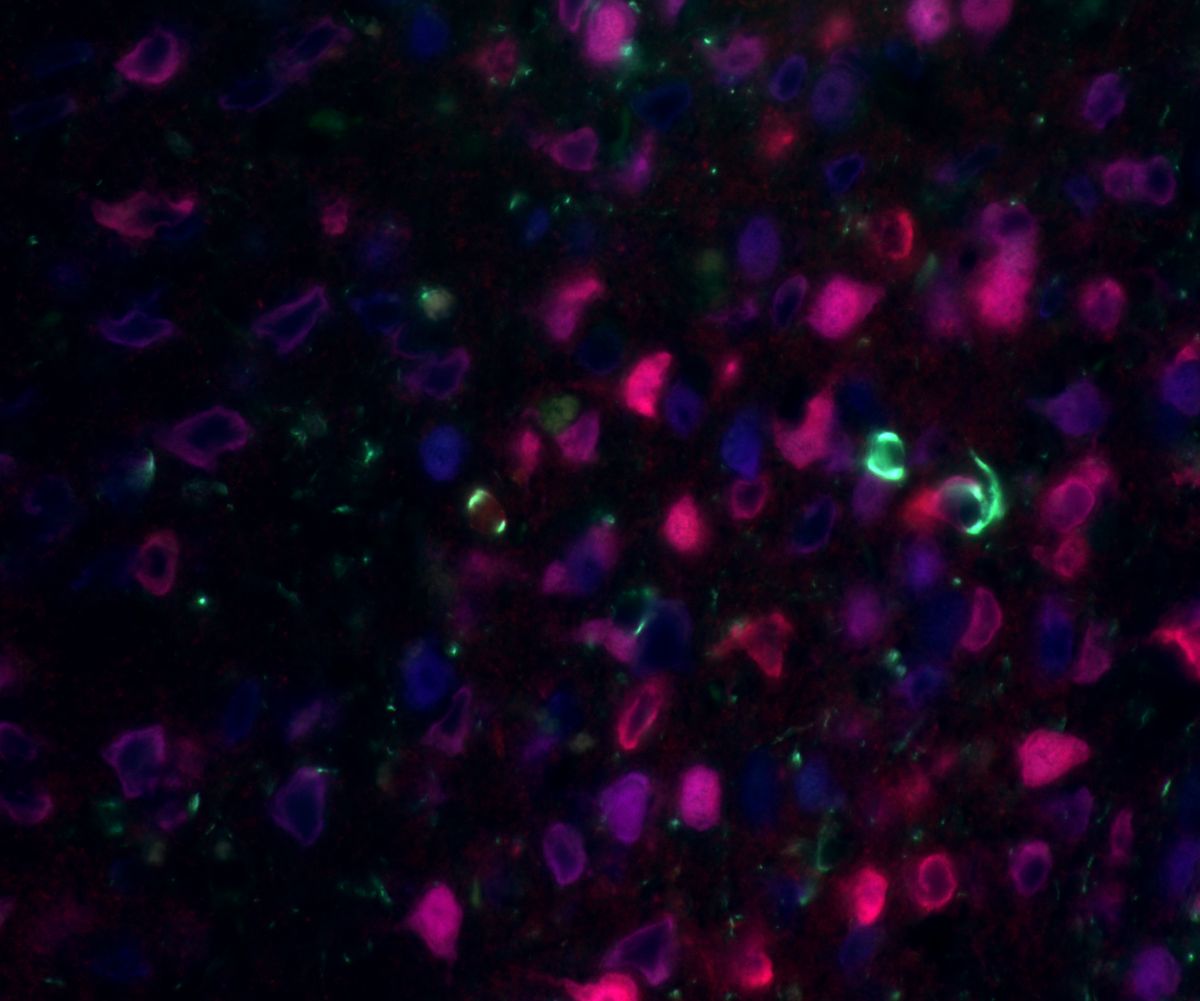 Immunofluorescence