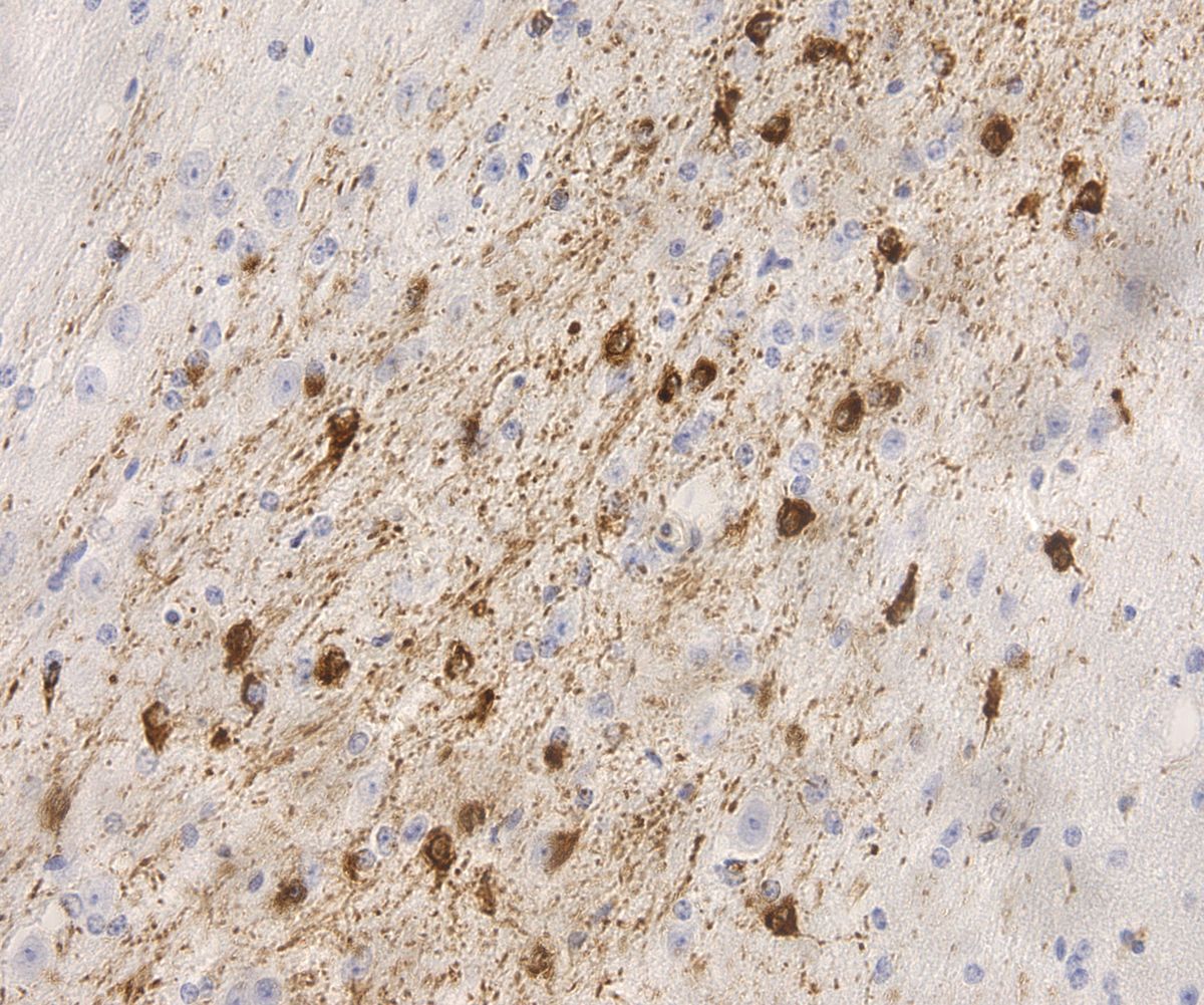 Immunohistochemistry