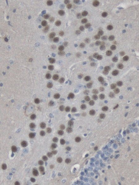 Immunohistochemistry